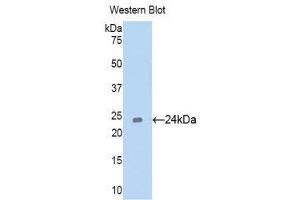 Western Blotting (WB) image for anti-Cell Division Cycle 25 Homolog B (S. Pombe) (CDC25B) (AA 377-566) antibody (ABIN1171796) (CDC25B 抗体  (AA 377-566))