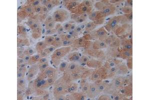 Used in DAB staining on fromalin fixed paraffin- embedded liver tissue (ERP29 抗体  (AA 42-173))