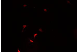 ABIN6266928 staining HeLa  cells by IF/ICC. (ZNF187 抗体  (Internal Region))
