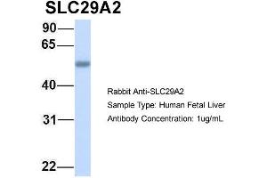 Western Blotting (WB) image for anti-Solute Carrier Family 29 (Nucleoside Transporters), Member 2 (SLC29A2) (C-Term) antibody (ABIN2781572)