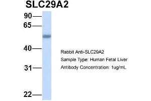 Host: Rabbit Target Name: SLC29A2 Sample Type: Human Fetal Liver Antibody Dilution: 1. (SLC29A2 抗体  (C-Term))