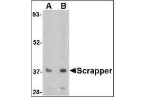 Western blot analysis of SCRAPPER in A20 cell lysate with this product at (A) 0. (FBXL20 抗体  (N-Term))