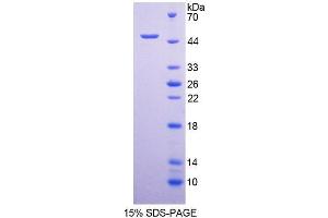 SDS-PAGE analysis of Human HCRP1 Protein. (VPS37A 蛋白)