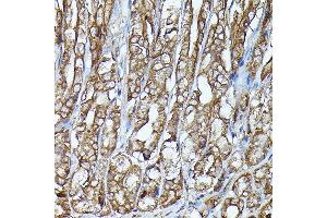 Immunohistochemistry of paraffin-embedded mouse stomach using J Rabbit pAb (ABIN7268040) at dilution of 1:100 (40x lens). (JAK2 抗体)