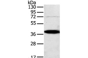 Western Blot analysis of A375 cell using SPARC Polyclonal Antibody at dilution of 1:500 (SPARC 抗体)