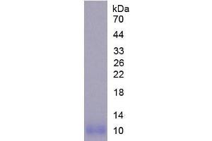 SDS-PAGE analysis of Mouse NOS2 Protein. (NOS2 蛋白)