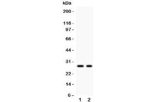 Western blot testing of Kallikrein 4 antibody and Lane 1:  293T;  2: MCF-7 lysate. (Kallikrein 4 抗体  (AA 31-254))