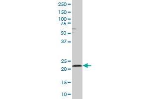 RAB4A MaxPab polyclonal antibody. (Rab4 抗体  (AA 1-218))