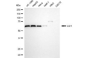 Western blotting analysis using LGI1 antibody (ABIN7799257). (Recombinant LGI1 抗体)