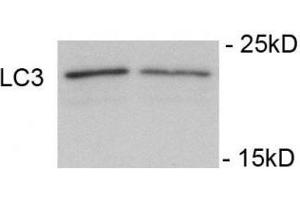 Immunoblots of SH-SY5Y cells treated with rapamycin for 1 h was probed with phospho-LC3C antibody. (LC3C 抗体  (pSer12))