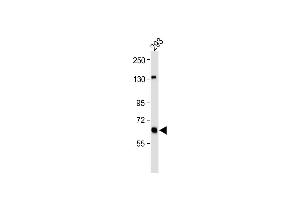 All lanes : Anti-GLS Antibody (C-term) at 1:1000 dilution Lane 1: 293 whole cell lysate Lysates/proteins at 20 μg per lane. (Glutaminase 抗体  (C-Term))