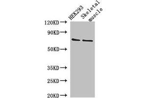 Western Blot Positive WB detected in: HEK293 whole cell lysate, Mouse skeletal muscle tissue All lanes: EFCAB7 antibody at 2. (EFCAB7 抗体  (AA 1-158))