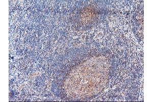 Image no. 1 for anti-Aminoacylase 1 (ACY1) antibody (ABIN1496455) (Aminoacylase 1 抗体)