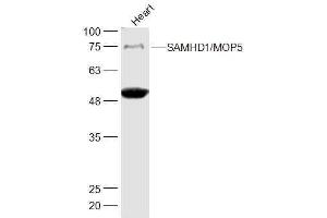 Mouse Heart lysates probed with SAMHD1'MOP5 Polyclonal Antibody, Unconjugated  at 1:500 dilution and 4˚C overnight incubation. (SAMHD1 抗体  (AA 256-370))