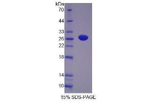 SDS-PAGE analysis of Rat NT5M Protein. (NT5M 蛋白)