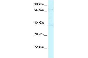 WB Suggested Anti-GSG2 Antibody Titration: 1. (GSG2 抗体  (N-Term))