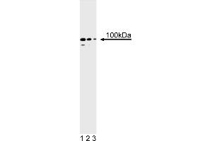 Western Blotting (WB) image for anti-PMS2 Postmeiotic Segregation Increased 2 (S. Cerevisiae) (PMS2) antibody (ABIN967525) (PMS2 抗体)