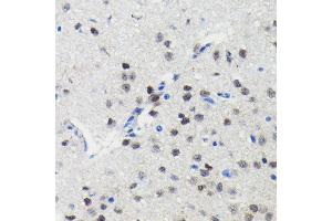 Immunohistochemistry of paraffin-embedded mouse brain using PIM1 antibody (ABIN7269375) at dilution of 1:100 (40x lens). (PIM1 抗体)
