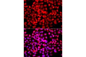 Immunofluorescence analysis of A549 cell using TDP1 antibody. (TDP1 抗体)