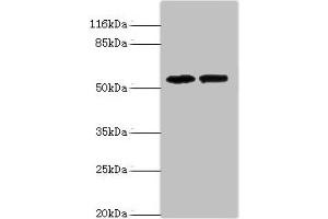 Western blot All lanes: PAIP1 antibody at 8 μg/mL Lane 1: Hela whole cell lysate Lane 2: PC-3 whole cell lysate Secondary Goat polyclonal to rabbit IgG at 1/10000 dilution Predicted band size: 54, 46, 43 kDa Observed band size: 54 kDa (PAIP1 抗体  (AA 1-260))