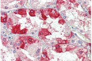 Kidney, Human: Formalin-Fixed, Paraffin-Embedded (FFPE) (Clathrin Heavy Chain (CLTC) (AA 1617-1630) 抗体)