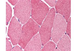 anti-B-Cell CLL/lymphoma 10 (BCL10) (AA 5-19) antibody