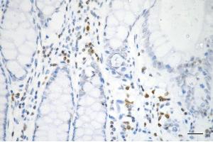Immunohistochemistry was performed on paraffin-embedded human sigmoid colon carcinoma using histone H3 (tri methyl K27) antibody (ABIN7798967), 1:200). (Recombinant Histone 3 抗体  (H3K27me3))