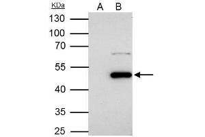 IP Image Flotillin 1 antibody [C3], C-term immunoprecipitates Flotillin 1 protein in IP experiments. (Flotillin 1 抗体  (C-Term))