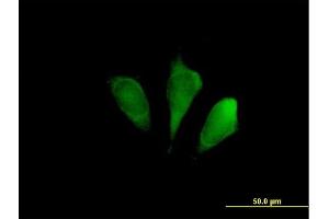 Immunofluorescence of purified MaxPab antibody to FBXO9 on HeLa cell.