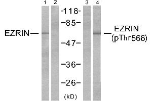 Western blot analysis of extracts from A431 cells, untreated or EGF-treated (200ng/ml, 30mins) using Ezrin (Ab-566) antibody (Line 1 and 2) and Ezrin (phospho-Tyr566) antibody (Line 3 and 4). (Ezrin 抗体  (pThr566))