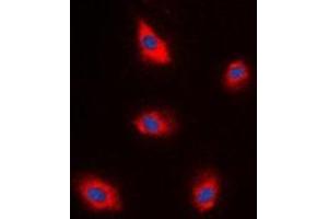 Immunofluorescent analysis of EPS8L1 staining in A549 cells. (EPS8-Like 1 抗体)