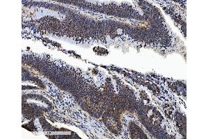 IHC analysis of PSMB5/MB1 using anti-PSMB5/MB1 antibody (ABIN7599183).