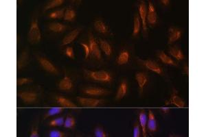 Immunofluorescence analysis of U-2 OS cells using NRBF2 Polyclonal Antibody at dilution of 1:100. (NRBF2 抗体)