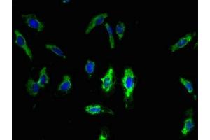 Immunofluorescent analysis of Hela cells using ABIN7173265 at dilution of 1:100 and Alexa Fluor 488-congugated AffiniPure Goat Anti-Rabbit IgG(H+L) (TMEM68 抗体  (AA 74-114))