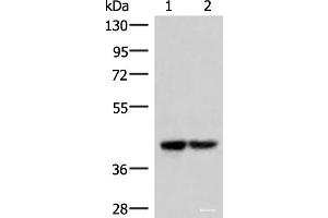 Western blot analysis of 293T cell lysates using IQCD Polyclonal Antibody at dilution of 1:1000 (IQCD 抗体)