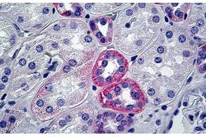 Human Kidney: Formalin-Fixed, Paraffin-Embedded (FFPE) (HSPG 抗体)