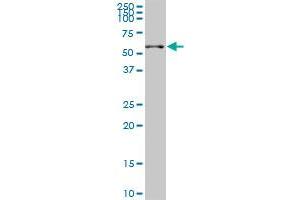 SGK2 monoclonal antibody (M03), clone 7A6. (SGK2 抗体  (AA 293-367))