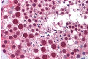 Human Testis: Formalin-Fixed, Paraffin-Embedded (FFPE) (MED17 抗体  (AA 551-652))