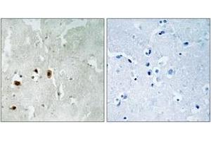 Immunohistochemistry analysis of paraffin-embedded human brain, using Tip60 (Phospho-Ser90) Antibody. (KAT5 抗体  (pSer90))