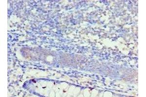 Immunohistochemistry (IHC) image for anti-Potassium Intermediate/small Conductance Calcium-Activated Channel, Subfamily N, Member 4 (KCNN4) (AA 288-427) antibody (ABIN7156944)