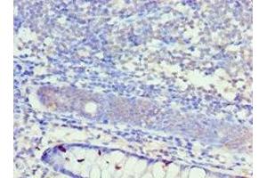 Immunohistochemistry of paraffin-embedded human colon tissue using ABIN7156944 at dilution of 1:100 (KCNN4 抗体  (AA 288-427))