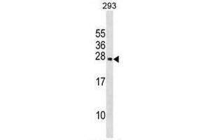 PRL Antibody (Center) western blot analysis in 293 cell line lysates (35µg/lane). (Prolactin 抗体  (Middle Region))