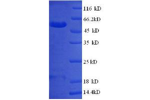 SDS-PAGE (SDS) image for Phosphatidylinositol Transfer Protein, Membrane-Associated 1 (PITPNM1) (AA 1-238), (partial) protein (GST tag) (ABIN7479259)