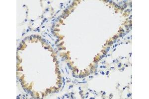 Immunohistochemistry of paraffin-embedded Mouse lung using FLT4 Polyclonal Antibody at dilution of 1:200 (40x lens). (FLT4 抗体)