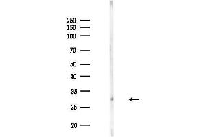 Western blot analysis of lysates from MDA-MB-231 cells(heat-shock,45 min treatment), using OR4L1 Antibody at 1/1000 dilution.