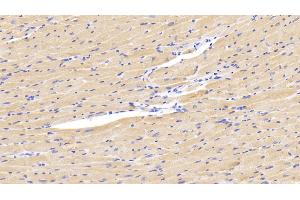 Detection of LOXL1 in Mouse Cardiac Muscle Tissue using Polyclonal Antibody to Lysyl Oxidase Like Protein 1 (LOXL1) (LOXL1 抗体  (AA 392-598))