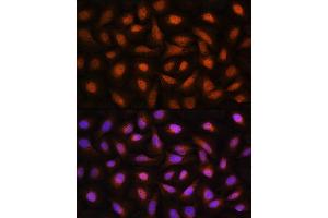 Immunofluorescence analysis of U2OS cells using CTBP2 Rabbit pAb (ABIN1679396, ABIN3015896, ABIN3015897 and ABIN6219473) at dilution of 1:100. (CTBP2 抗体  (C-Term))