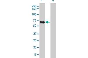 Western Blot analysis of FBLIM1 expression in transfected 293T cell line by FBLIM1 monoclonal antibody (M10), clone 5E11. (FBLIM1 抗体  (AA 270-373))
