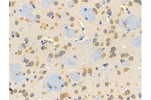 ABIN6257892 and ABIN6274756 at 1/100 staining Mouse brain tissue by IHC-P.