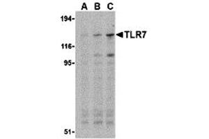 Western Blotting (WB) image for anti-Toll-Like Receptor 7 (TLR7) (Middle Region) antibody (ABIN1031131)